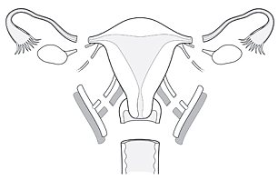 uterus-transplant1