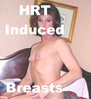 Shemale Hormone Tits - Hormone Replacement Therapy for MTF Transgender | Renee Reyes